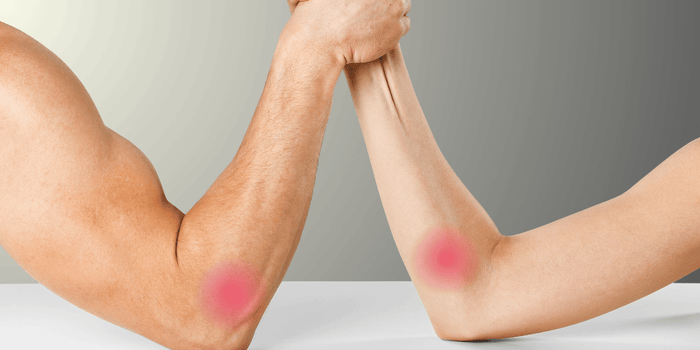 Tennis Elbow vs. Golfer's Elbow based on pain location